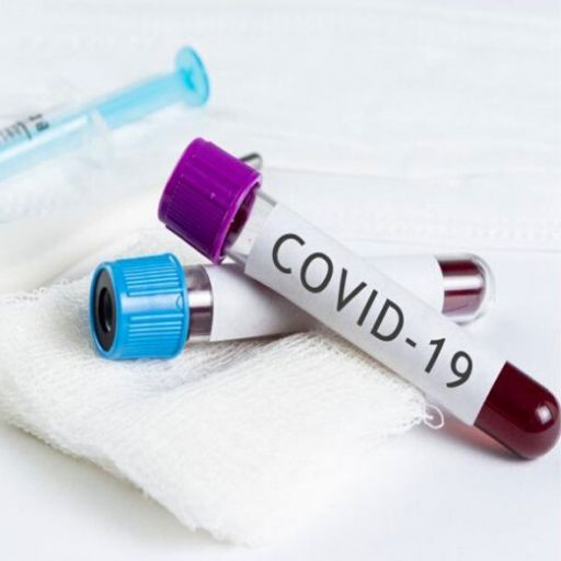 Lazio: si registrano 1.039 casi positivi, 43 decessi e 2.525 guariti