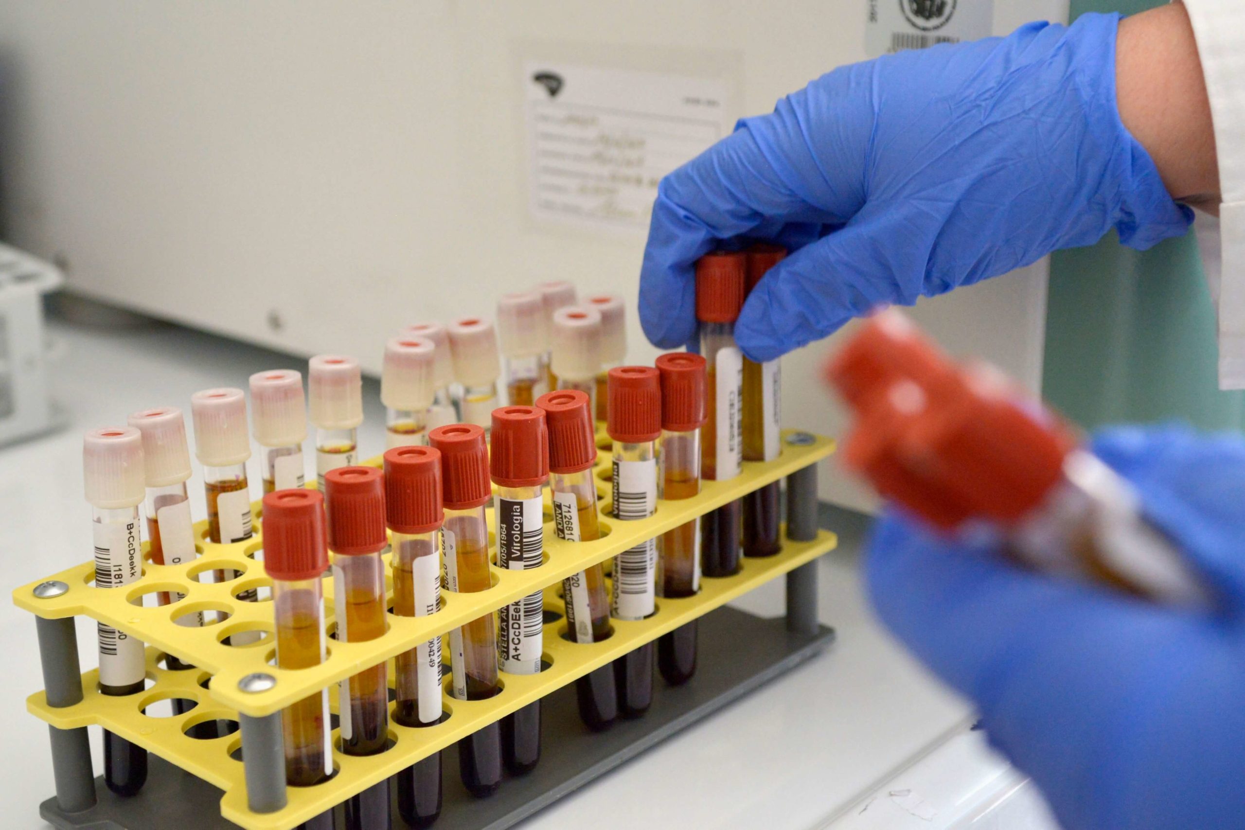 Regione Lazio: elenco delle strutture private autorizzate per tamponi rapidi